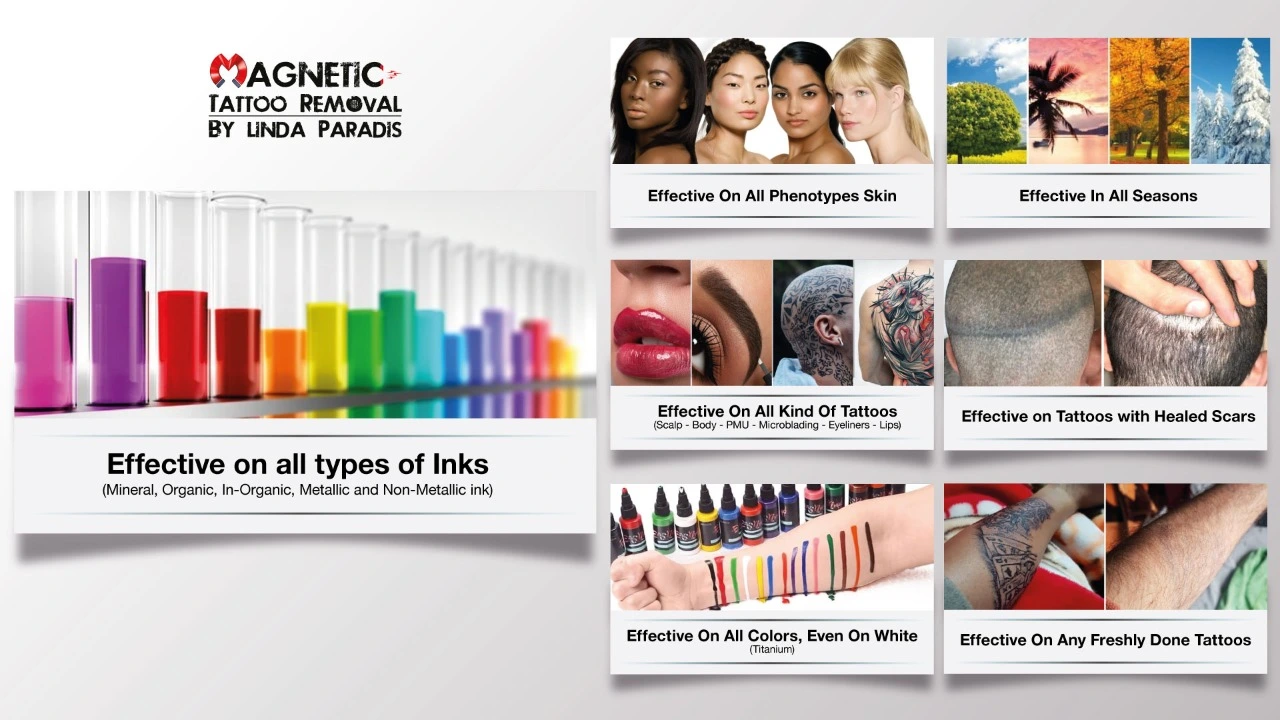 Non-Invasive Tattoo Magnetic Tattoo Removal By Linda Paradis
