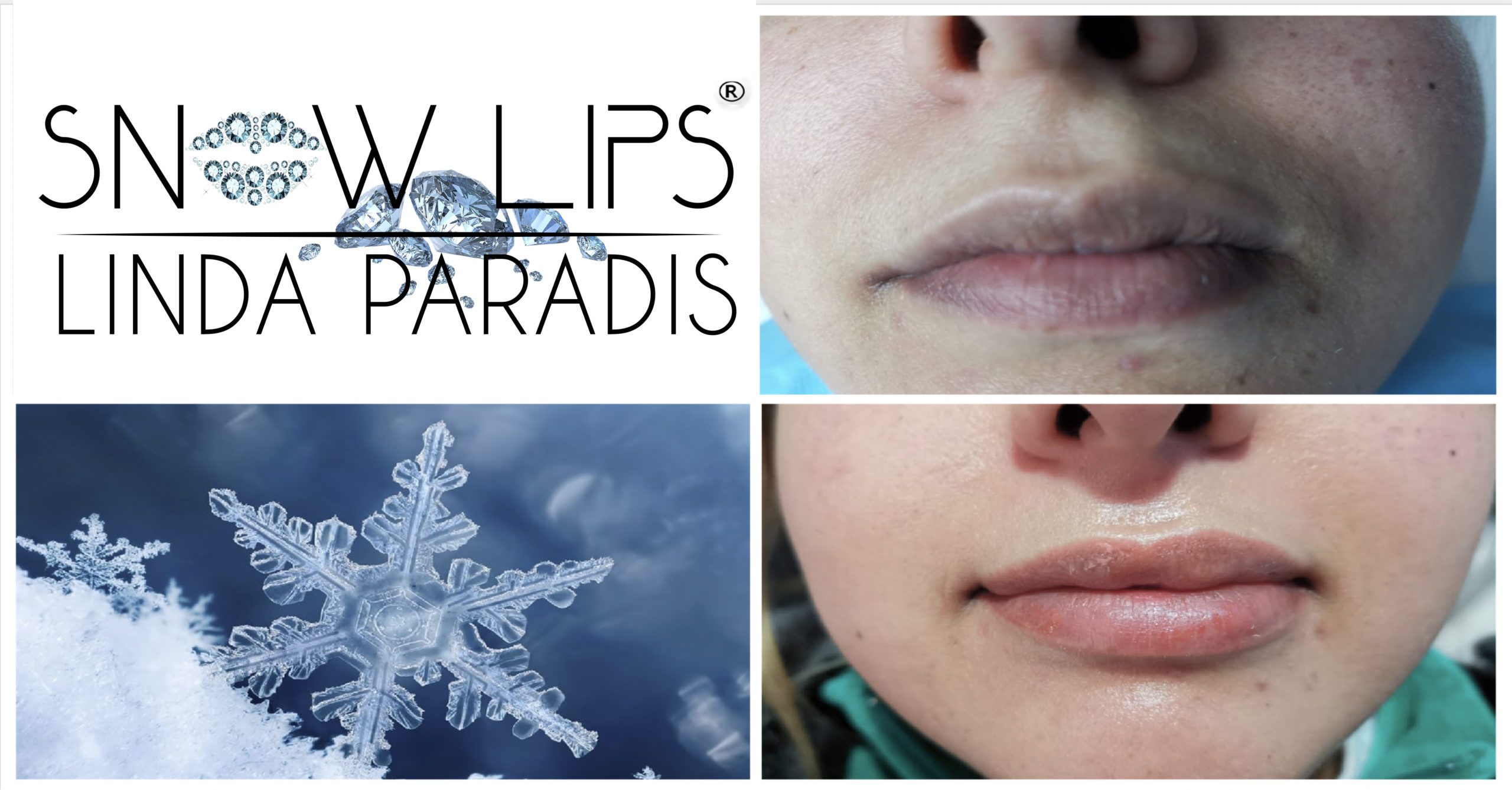 Non-Invasive Magnetic Tattoo Removal Technique by Linda Paradis