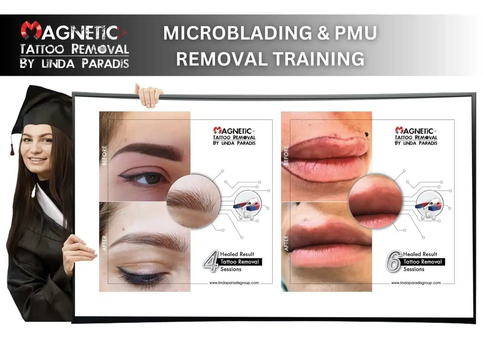 Non-Invasive Magnetic Tattoo Removal for Microblading and Permanent Makeup Removal — Live Online Hands-On Training