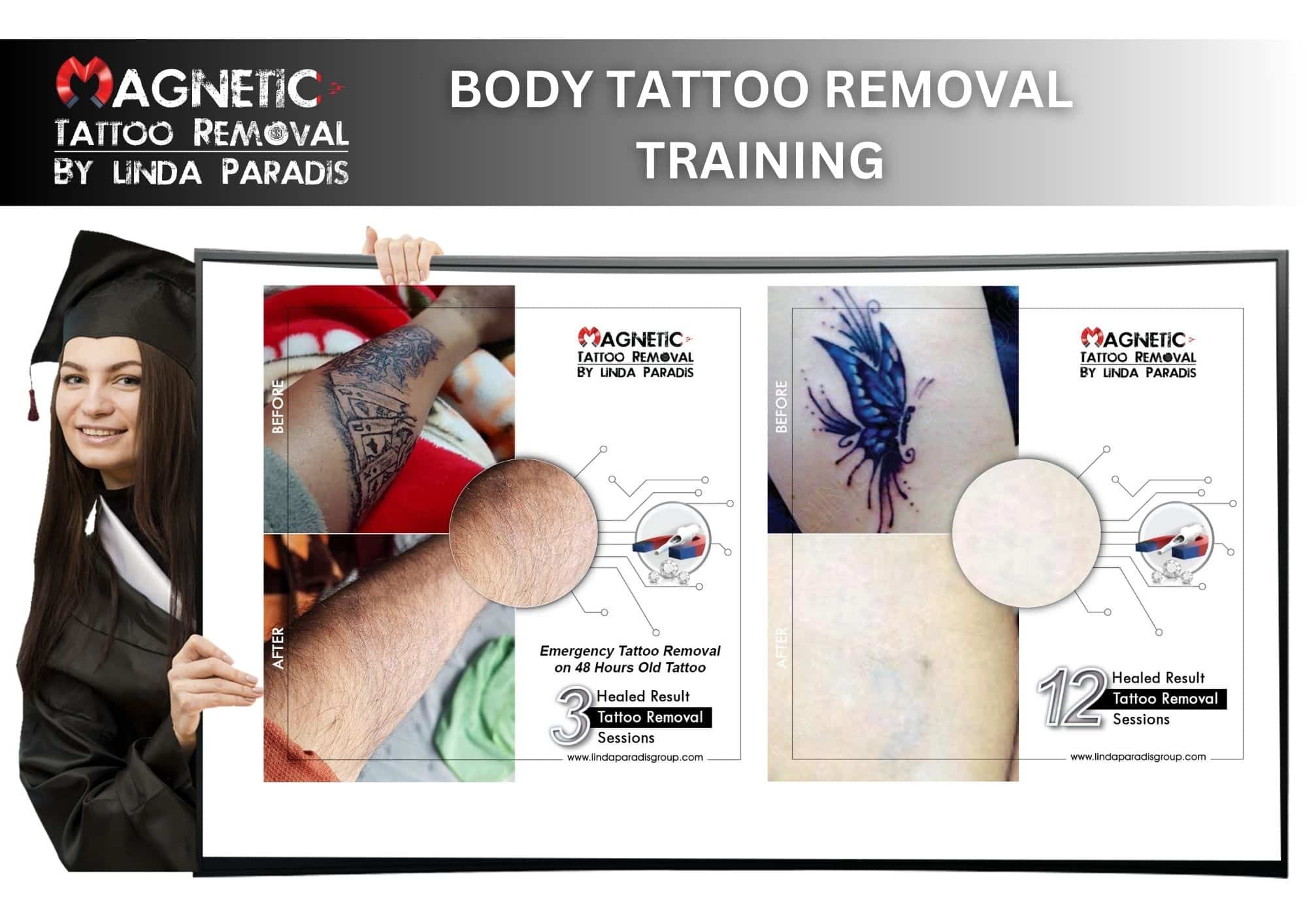 Magnetic Tattoo Removal for Body tattoo Removal training course
