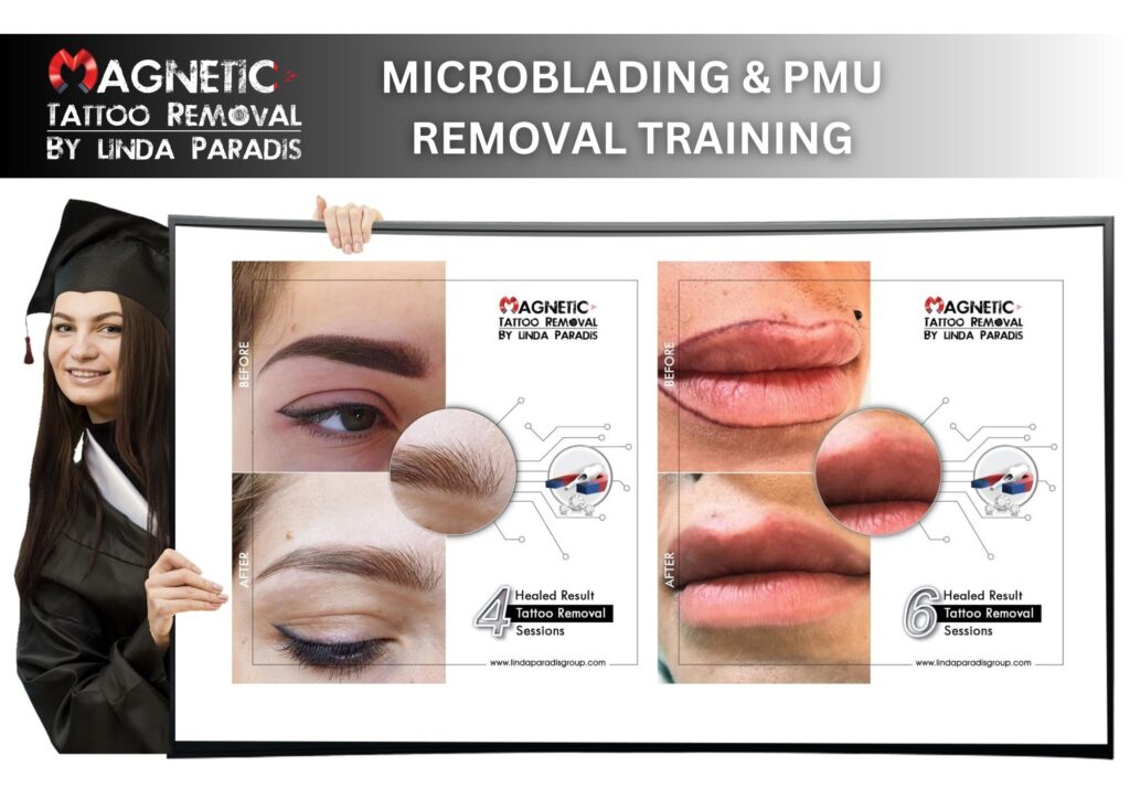 Magnetic tattoo Removal Microblading and PMU Removal training course